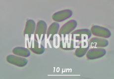 Amylostereum chailletii
